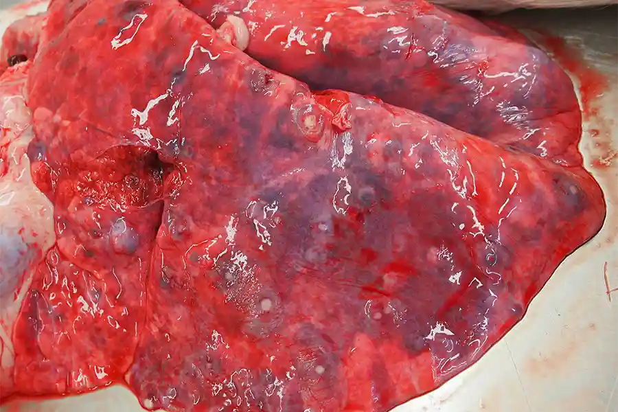 Lungs of goat with melioidosis. Throughout the lungs, there are multiple red congested areas with central white zones of pus. The pattern of the lesions throughout the lungs reflects spread of the bacteria through the bloodstream.
